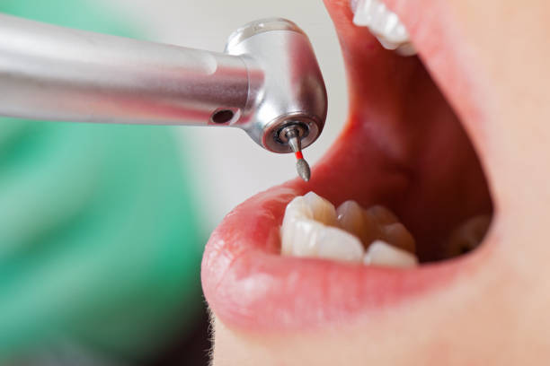 Best Emergency Orthodontic Repairs in Nederland, TX